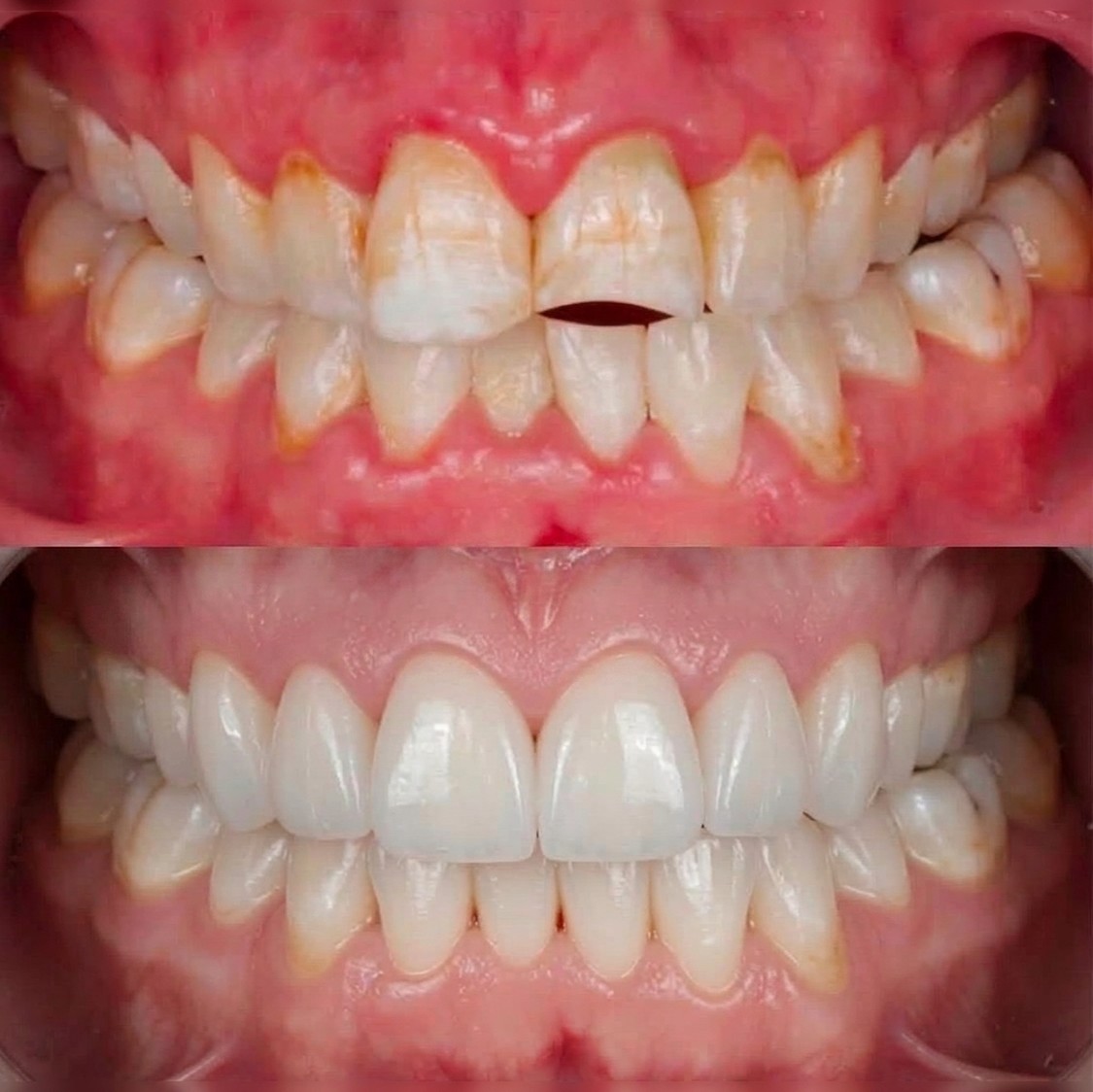 B/ARTistry Systems case — before and after